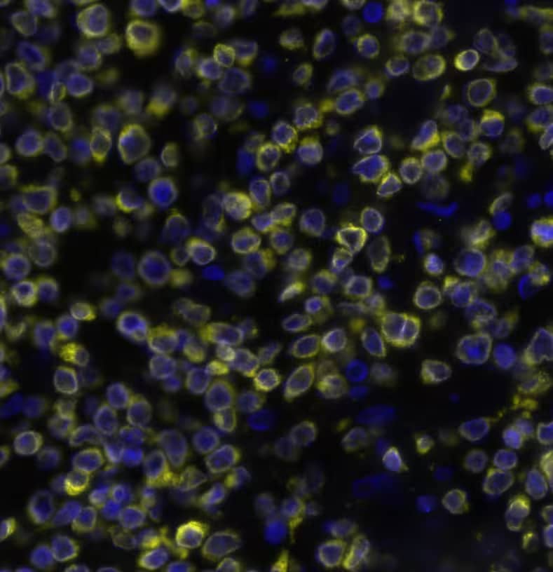 BCL2 was detected in immersion fixed paraffin-embedded sections of human Non-Hodgkin’s Lymphoma using Mouse Anti-Human BCL2, Monoclonal Antibody (Catalog #NBP2-34443) at a 1:500 dilution at 37 ° Celsius for 4 minutes. Before incubation with the primary antibody, tissue underwent an all-in-one dewaxing and antigen retrieval preprocessing using PreTreatment Module (PT Module) and Dewax and HIER Buffer H (pH 9; Epredia Catalog # TA-999-DHBH). TTissue was stained using the Alexa Fluor™ 647 Goat anti-Mouse IgG Secondary Antibody at 1:200 at 37 ° Celsius for 2 minutes. (Yellow; Lunaphore Catalog # DR647MS) and counterstained with DAPI (blue; Lunaphore Catalog # DR100). Specific staining was localized to the membrane. Protocol available in COMET™ Panel Builder.